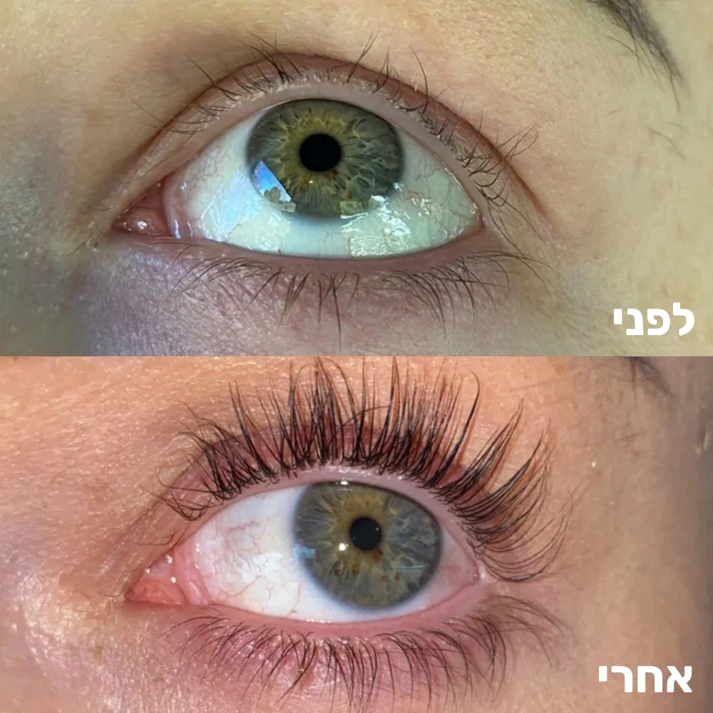 סרום מצמיח ריסים