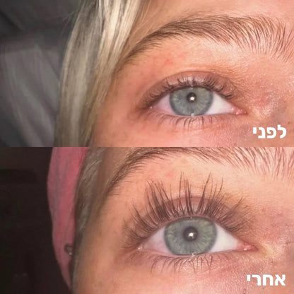 סרום מצמיח ריסים